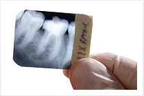 Oral Cancer & Disease Screening